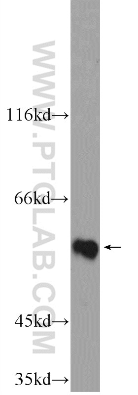 Western Blot (WB) analysis of HL-60 cells using ZNF649 Polyclonal antibody (25797-1-AP)
