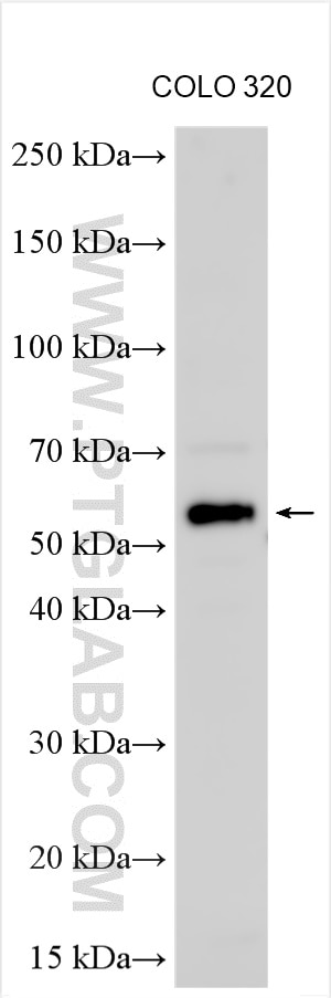 Western Blot (WB) analysis of various lysates using ZNF649 Polyclonal antibody (25797-1-AP)
