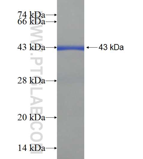 ZNF649 fusion protein Ag22700 SDS-PAGE