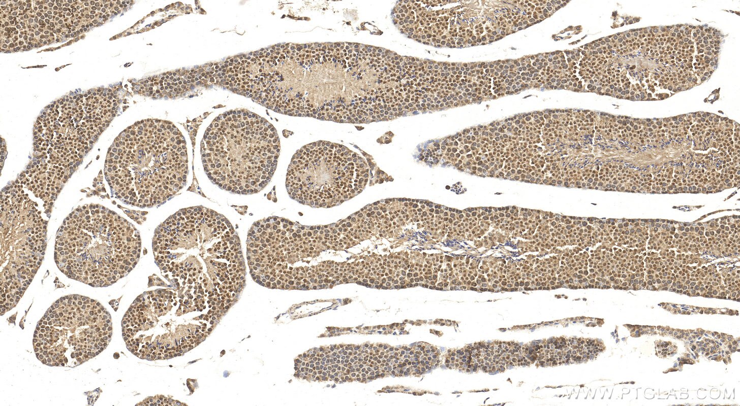 Immunohistochemistry (IHC) staining of mouse testis tissue using ZNF653 Polyclonal antibody (27590-1-AP)