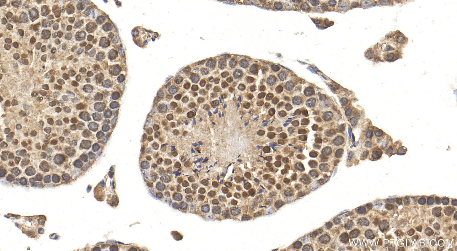 Immunohistochemistry (IHC) staining of mouse testis tissue using ZNF653 Polyclonal antibody (27590-1-AP)
