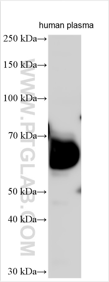 Western Blot (WB) analysis of various lysates using ZNF653 Polyclonal antibody (27590-1-AP)
