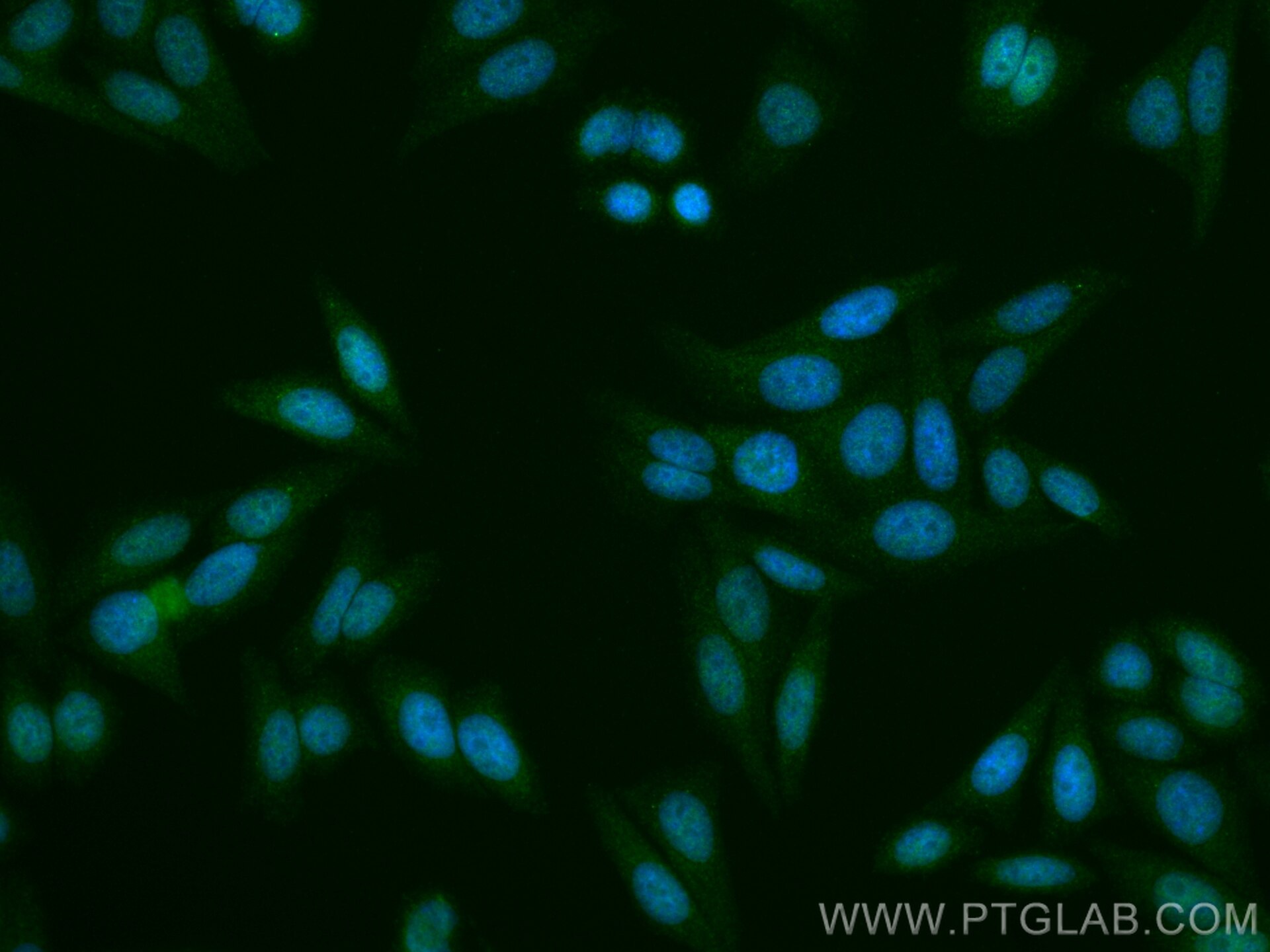 Immunofluorescence (IF) / fluorescent staining of HepG2 cells using ZNF654 Polyclonal antibody (24596-1-AP)