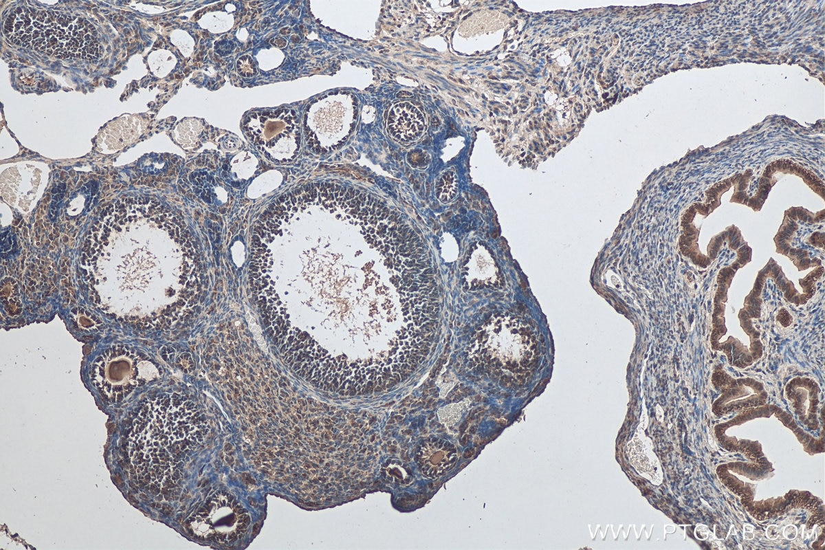 IHC staining of mouse ovary using 24596-1-AP