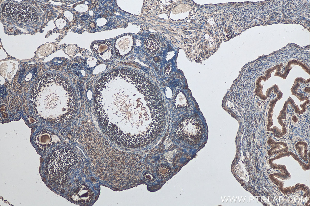 Immunohistochemistry (IHC) staining of mouse ovary tissue using ZNF654 Polyclonal antibody (24596-1-AP)