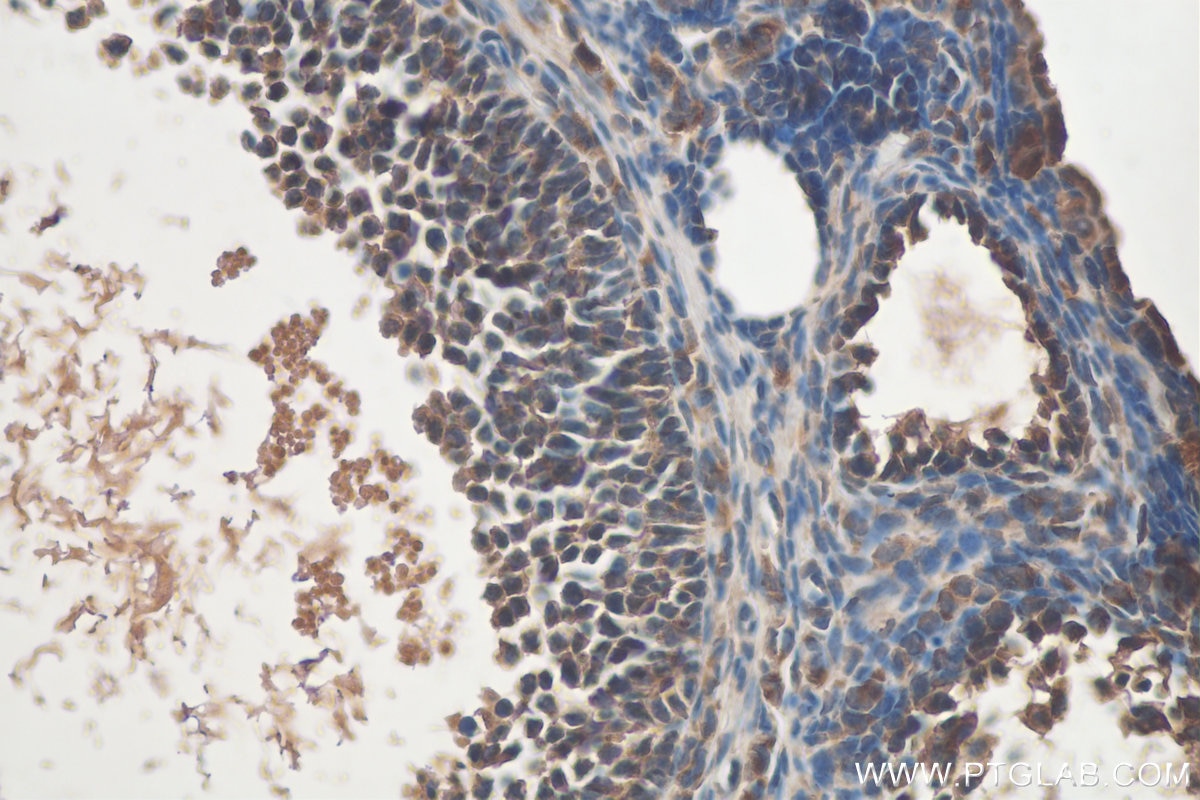 Immunohistochemistry (IHC) staining of mouse ovary tissue using ZNF654 Polyclonal antibody (24596-1-AP)