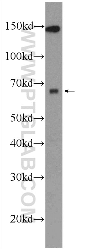 Western Blot (WB) analysis of MCF-7 cells using ZNF654 Polyclonal antibody (24596-1-AP)