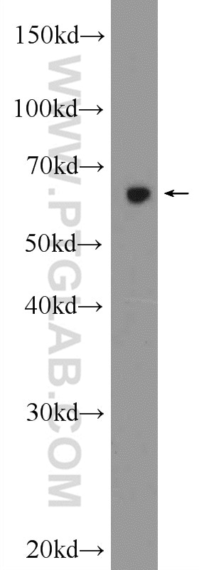 Western Blot (WB) analysis of mouse ovary tissue using ZNF654 Polyclonal antibody (24596-1-AP)