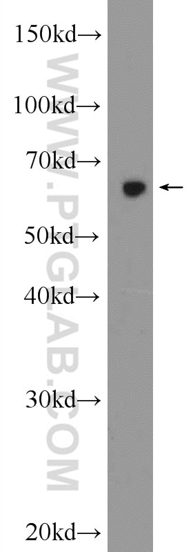 WB analysis of mouse ovary using 24596-1-AP