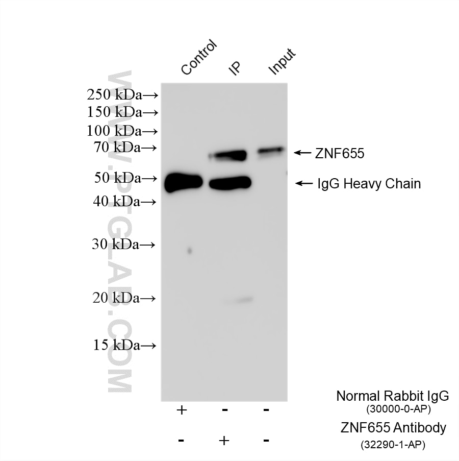 Immunoprecipitation (IP) experiment of HEK-293 cells using ZNF655 Polyclonal antibody (32290-1-AP)