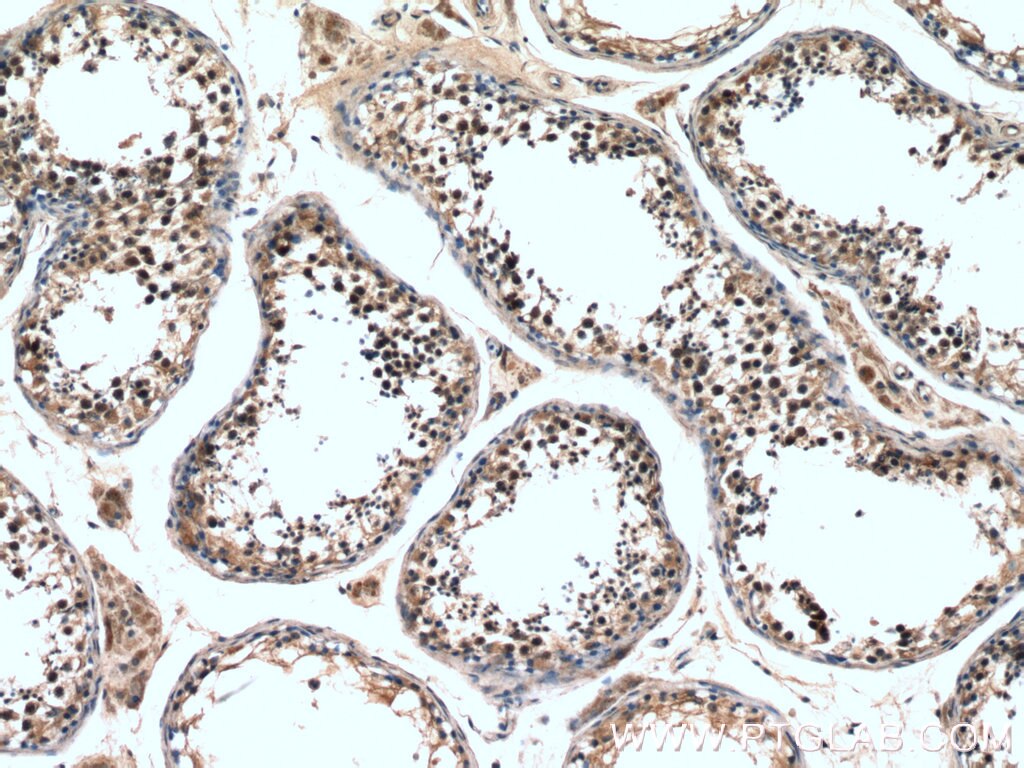 Immunohistochemistry (IHC) staining of human testis tissue using ZNF658 Polyclonal antibody (24823-1-AP)
