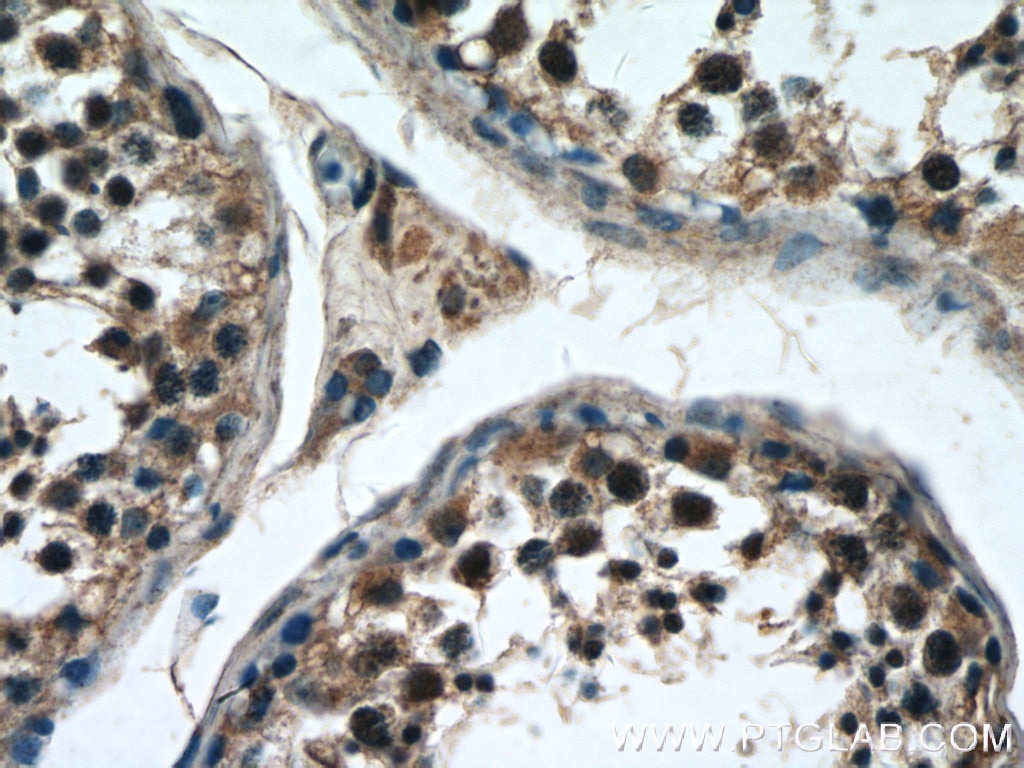 Immunohistochemistry (IHC) staining of human testis tissue using ZNF658 Polyclonal antibody (24823-1-AP)