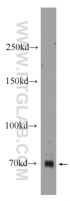 Western Blot (WB) analysis of fetal human brain tissue using ZNF658 Polyclonal antibody (24823-1-AP)