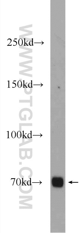 Western Blot (WB) analysis of rat brain tissue using ZNF658 Polyclonal antibody (24823-1-AP)