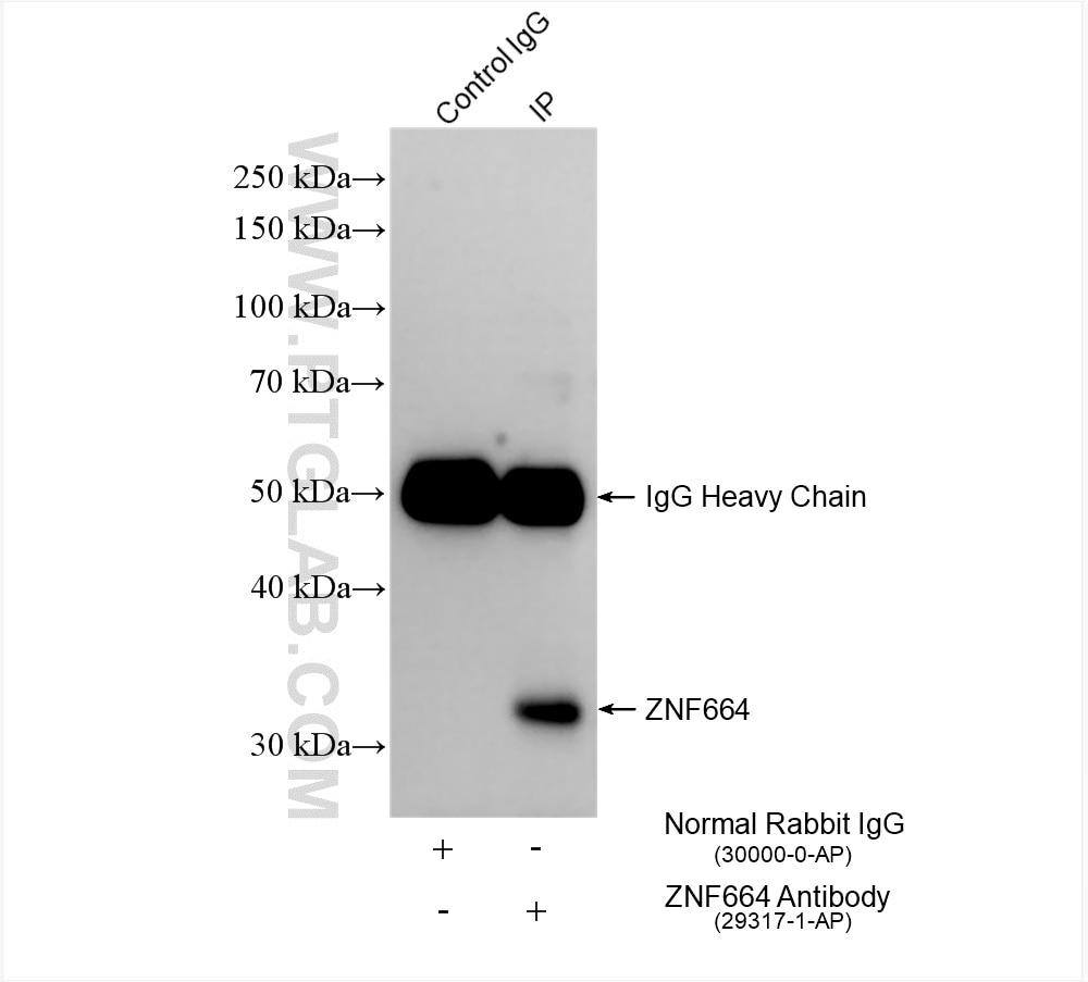 Immunoprecipitation (IP) experiment of mouse liver tissue using ZNF664 Polyclonal antibody (29317-1-AP)