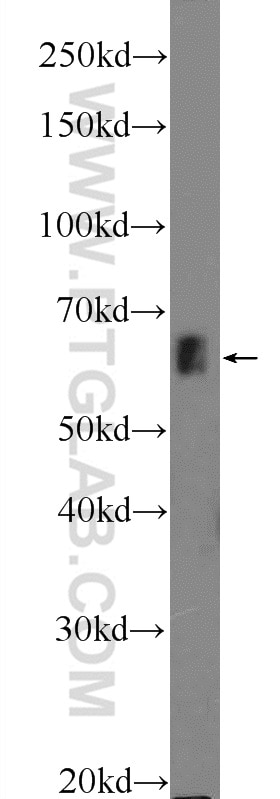 Western Blot (WB) analysis of COLO 320 cells using ZNF668 Polyclonal antibody (25669-1-AP)