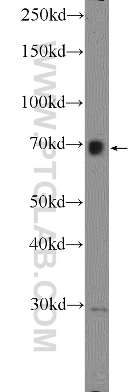 Western Blot (WB) analysis of HepG2 cells using ZNF668 Polyclonal antibody (25669-1-AP)