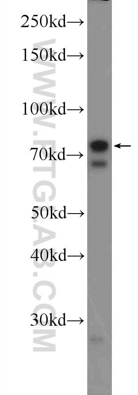 Western Blot (WB) analysis of A549 cells using ZNF668 Polyclonal antibody (25669-1-AP)