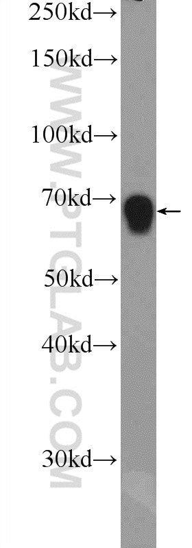 Western Blot (WB) analysis of COLO 320 cells using ZNF668 Polyclonal antibody (25669-1-AP)