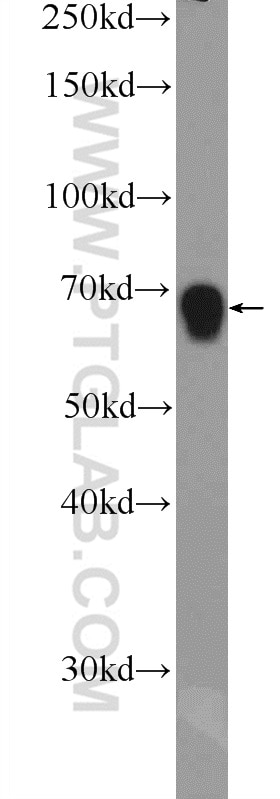 WB analysis of COLO 320 using 25669-1-AP