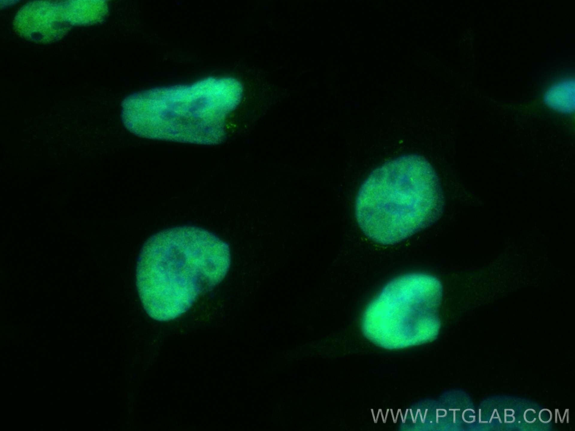 Immunofluorescence (IF) / fluorescent staining of U-251 cells using ZNF671 Polyclonal antibody (21329-1-AP)