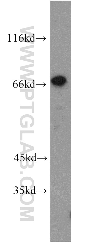 Western Blot (WB) analysis of HepG2 cells using ZNF671 Polyclonal antibody (21329-1-AP)