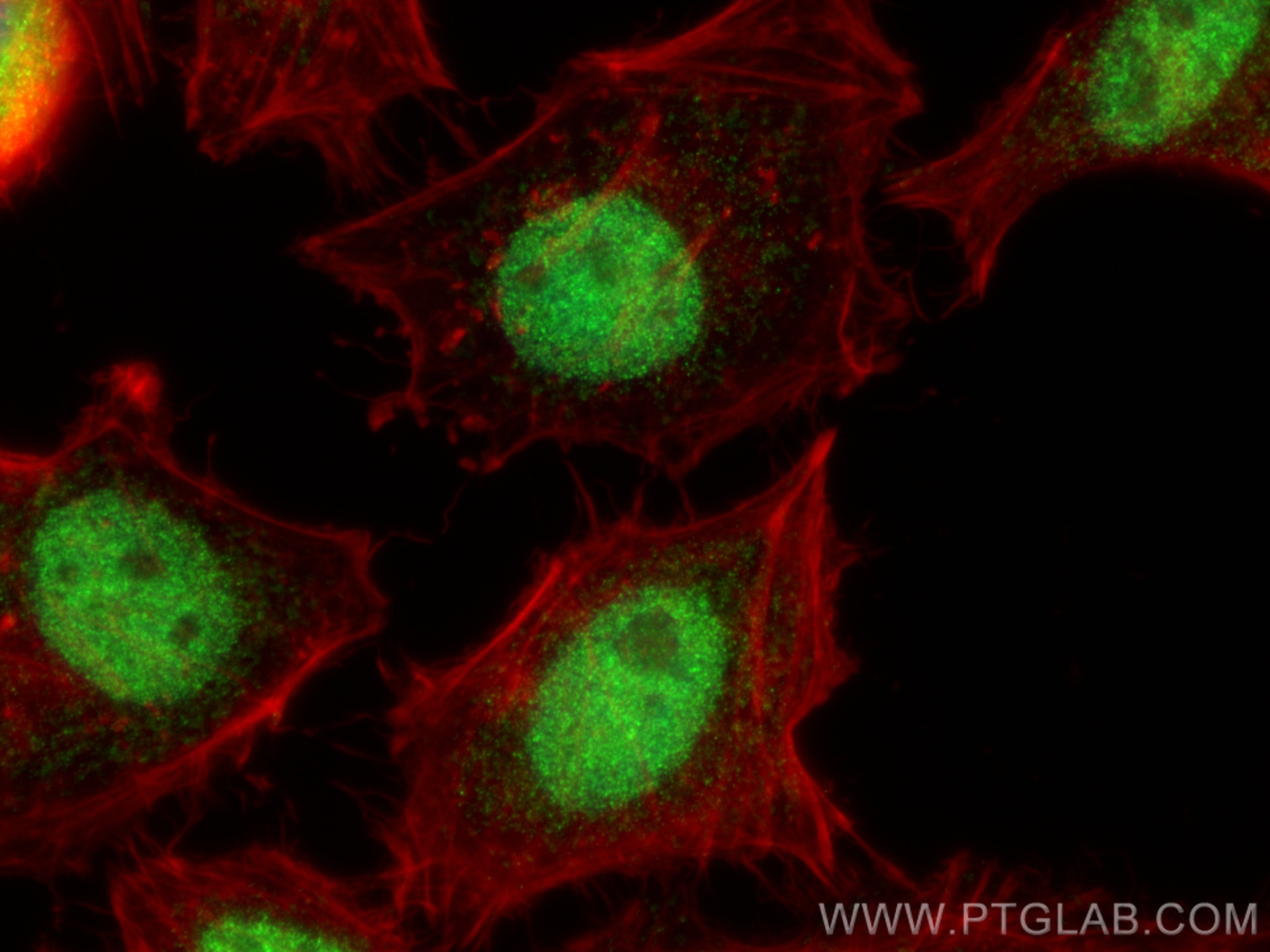 Immunofluorescence (IF) / fluorescent staining of HeLa cells using ZNF672 Polyclonal antibody (25794-1-AP)