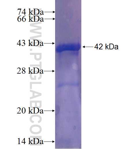 ZNF672 fusion protein Ag22886 SDS-PAGE