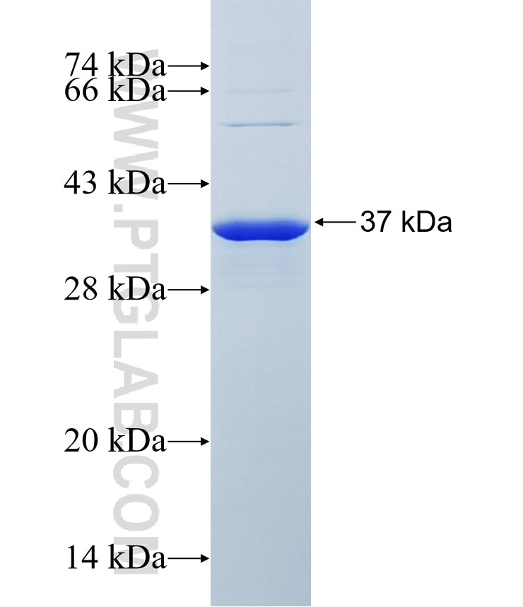 ZNF683 fusion protein Ag37042 SDS-PAGE ZNF683 fusion protein Ag37042 SDS-PAGE