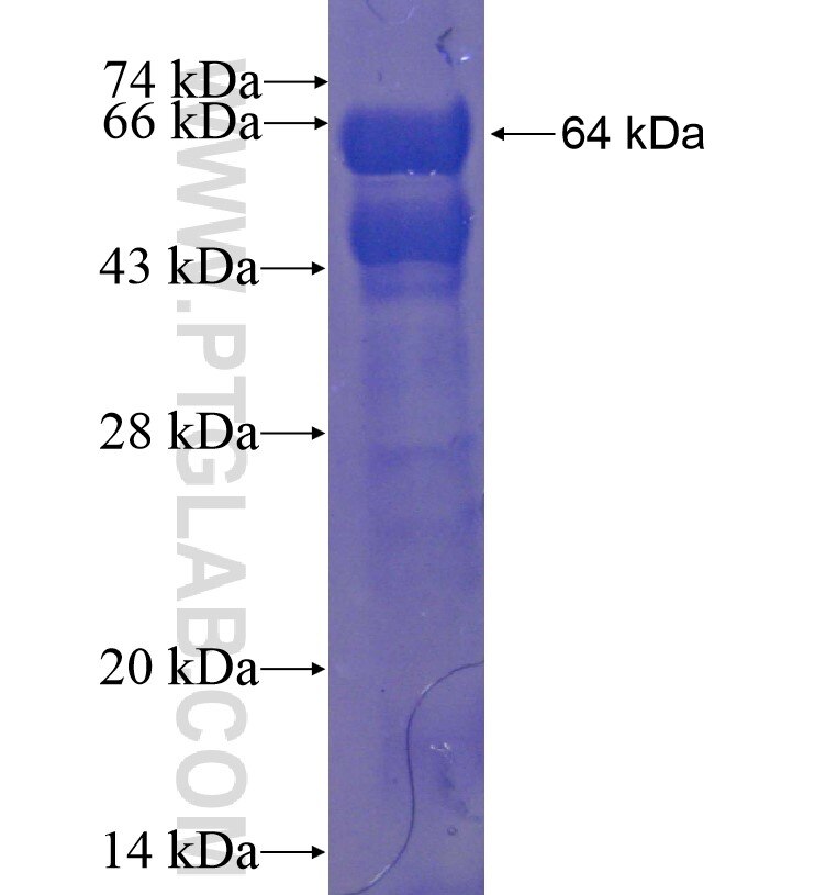 ZNF687 fusion protein Ag16264 SDS-PAGE