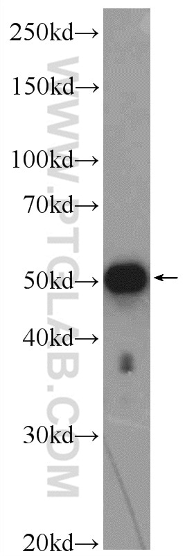 Western Blot (WB) analysis of HeLa cells using ZNF689 Polyclonal antibody (25573-1-AP)