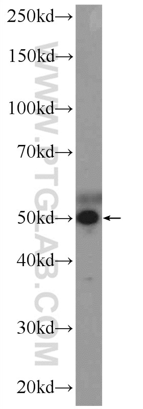 Western Blot (WB) analysis of HepG2 cells using ZNF689 Polyclonal antibody (25573-1-AP)