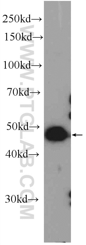 Western Blot (WB) analysis of mouse testis tissue using ZNF689 Polyclonal antibody (25573-1-AP)
