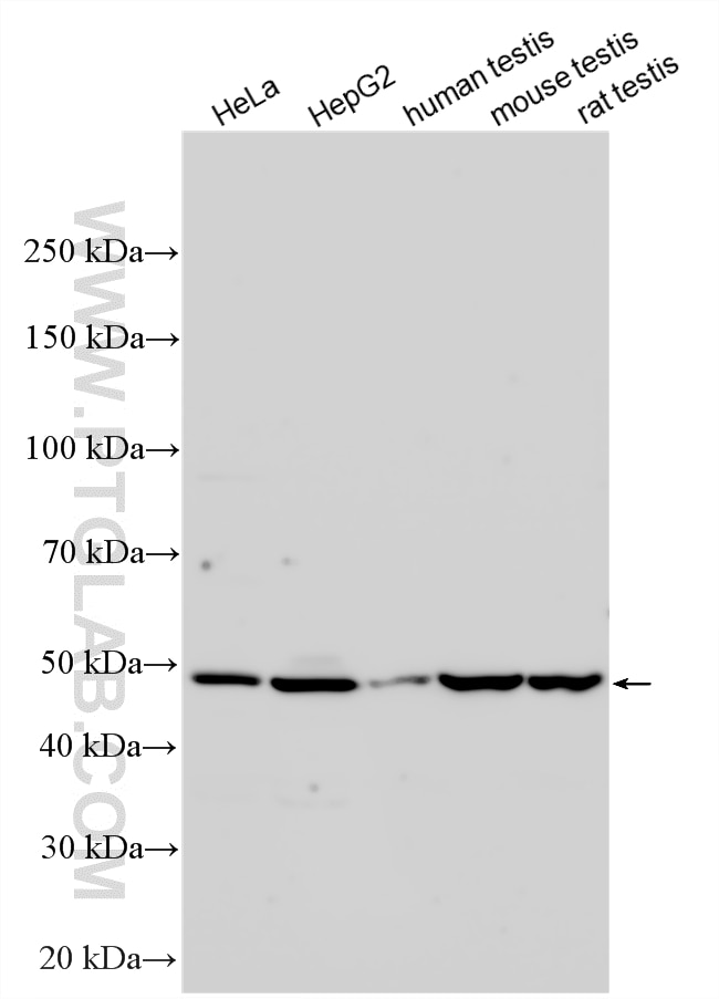 Various lysates were subjected to SDS PAGE followed by western blot with 25573-1-AP (ZNF689 antibody) at dilution of 1:3000 incubated at room temperature for 1.5 hours. Western Blot (WB) analysis of various lysates using ZNF689 Polyclonal antibody (25573-1-AP)
