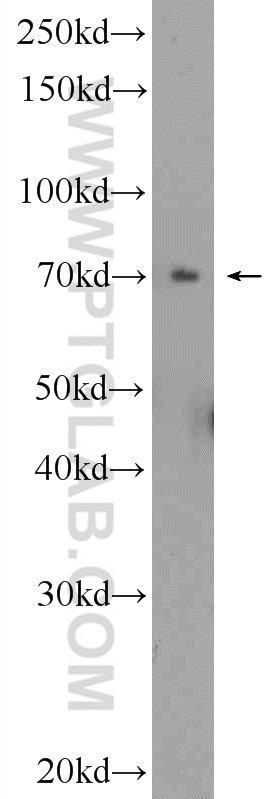 Western Blot (WB) analysis of HepG2 cells using ZNF695 Polyclonal antibody (25556-1-AP)