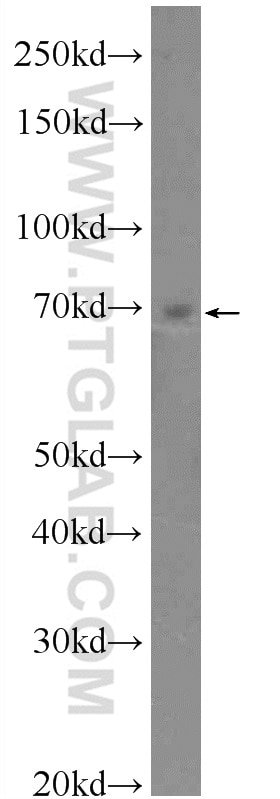 Western Blot (WB) analysis of HeLa cells using ZNF695 Polyclonal antibody (25556-1-AP)