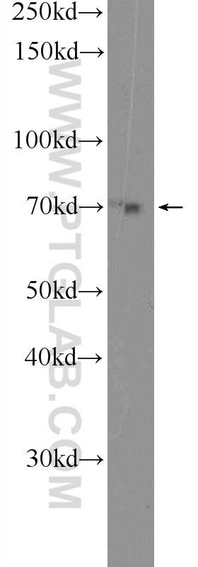 Western Blot (WB) analysis of HeLa cells using ZNF695 Polyclonal antibody (25556-1-AP)