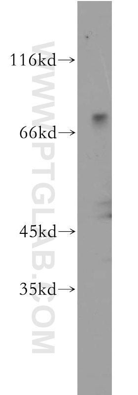 Western Blot (WB) analysis of human brain tissue using ZNF699 Polyclonal antibody (21562-1-AP)