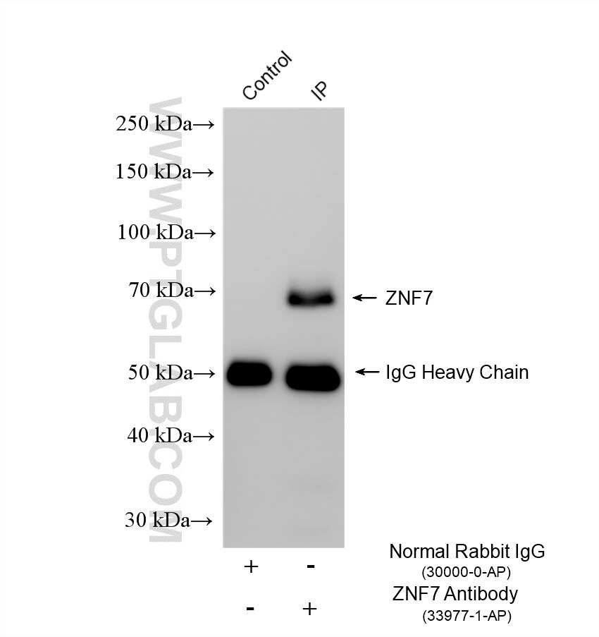 IP experiment of HL-60 using 33977-1-AP (same clone as 33977-1-PBS) Immunoprecipitation (IP) experiment of HL-60 cells using ZNF7 Polyclonal antibody (33977-1-AP)
