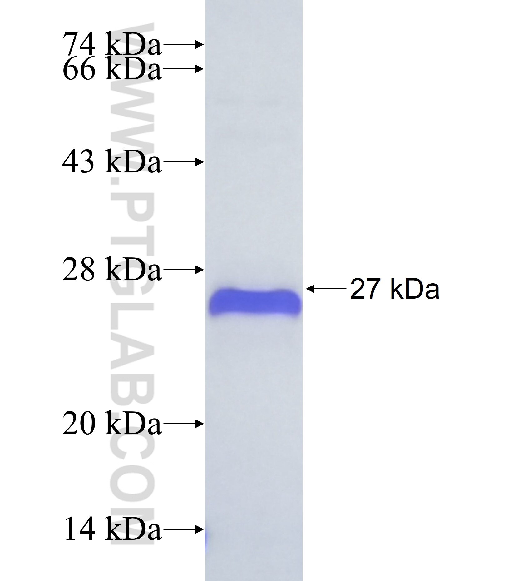 ZNF70 fusion protein Ag38019 SDS-PAGE ZNF70 fusion protein Ag38019 SDS-PAGE