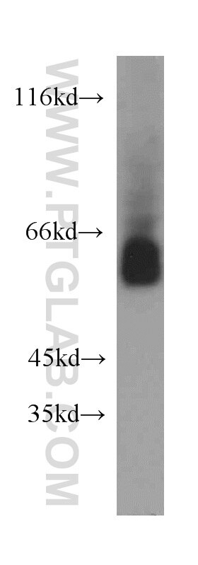 Western Blot (WB) analysis of human brain tissue using ZNF703 Polyclonal antibody (21075-1-AP)