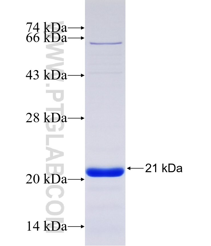 ZNF704 fusion protein Ag37028 SDS-PAGE