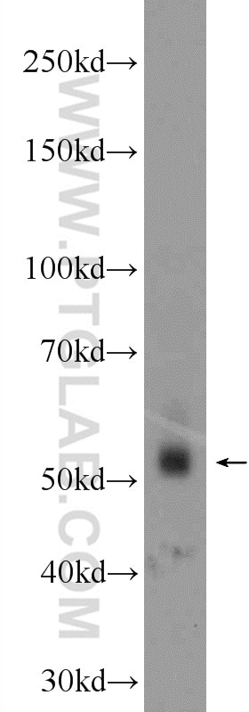 Western Blot (WB) analysis of Jurkat cells using ZNF71 Polyclonal antibody (24647-1-AP)
