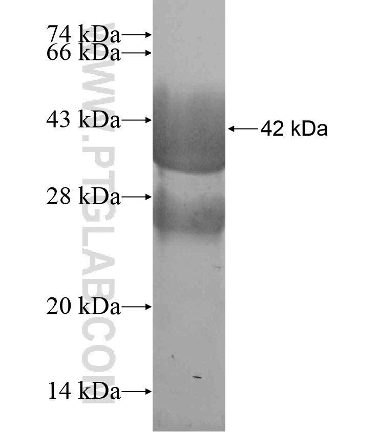 ZNF71 fusion protein Ag18371 SDS-PAGE