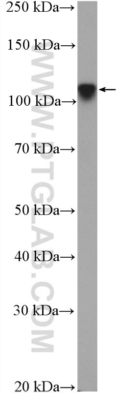 Western Blot (WB) analysis of SKOV-3 cells using ZNF711 Polyclonal antibody (25166-1-AP)