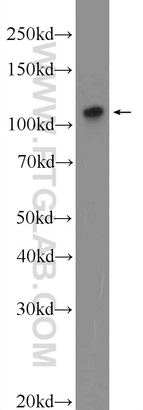 Western Blot (WB) analysis of mouse testis tissue using ZNF711 Polyclonal antibody (25166-1-AP)