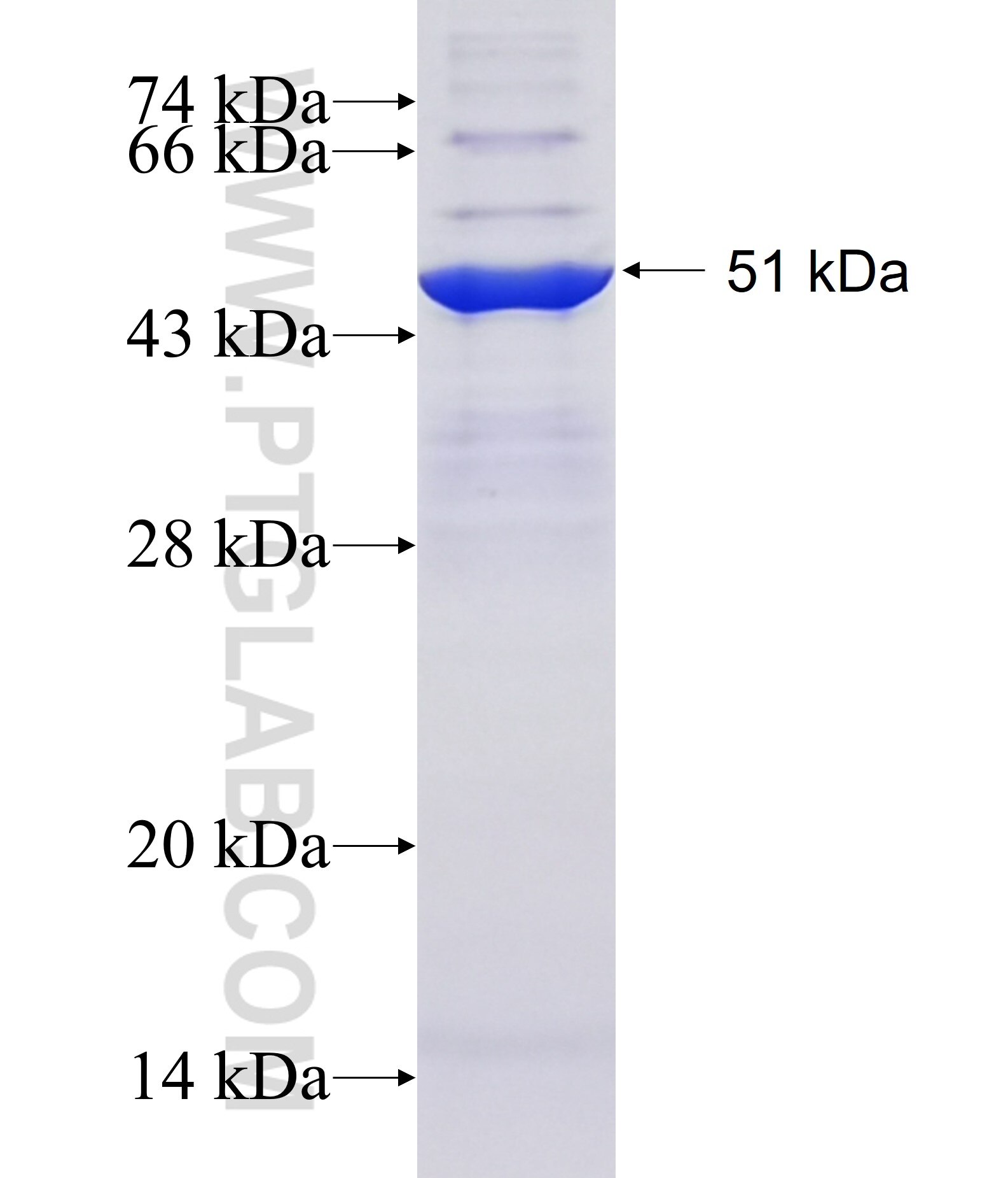 ZNF713 fusion protein Ag22349 SDS-PAGE