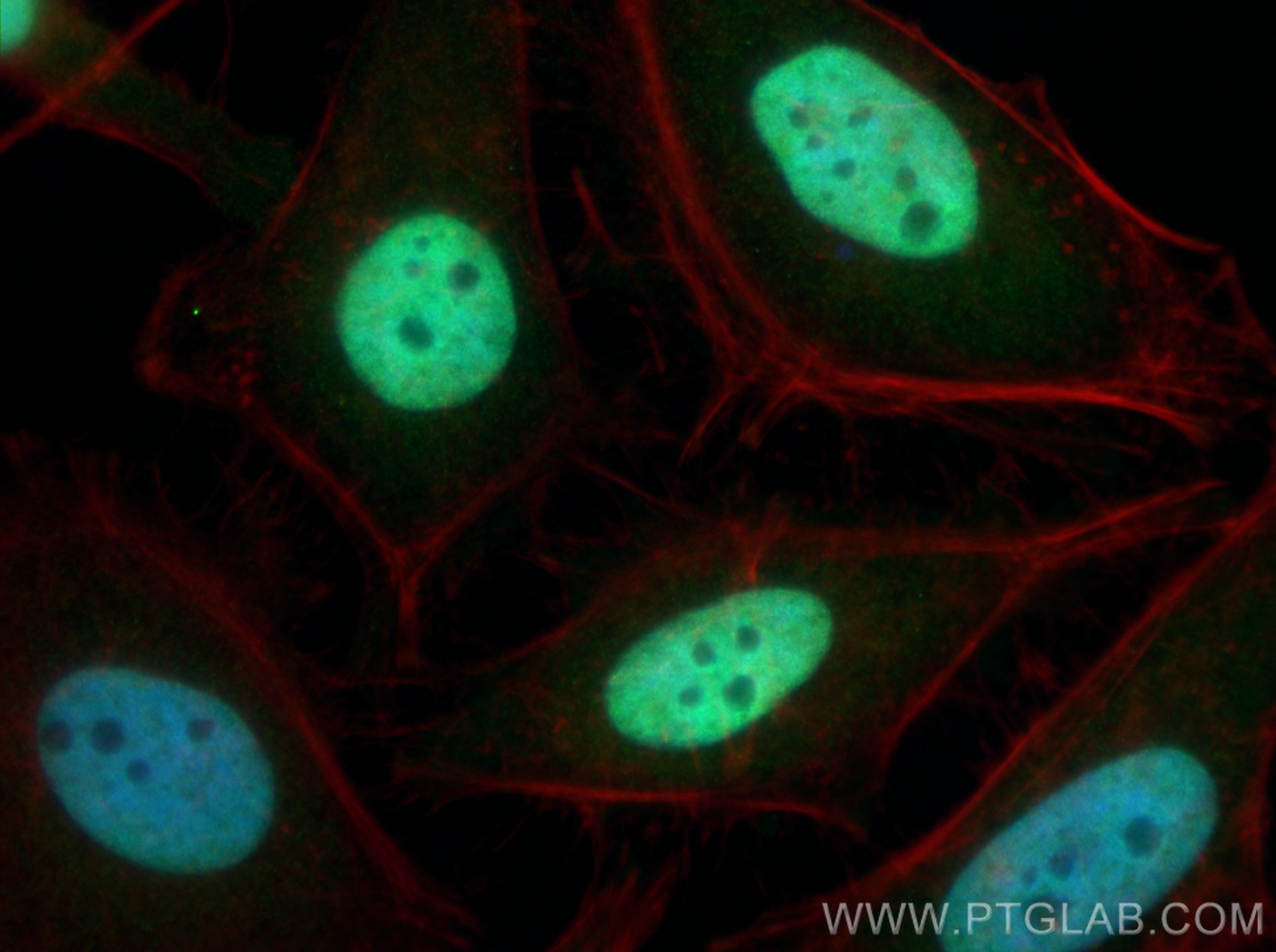 Immunofluorescence (IF) / fluorescent staining of HeLa cells using ZNF718 Polyclonal antibody (22074-1-AP)