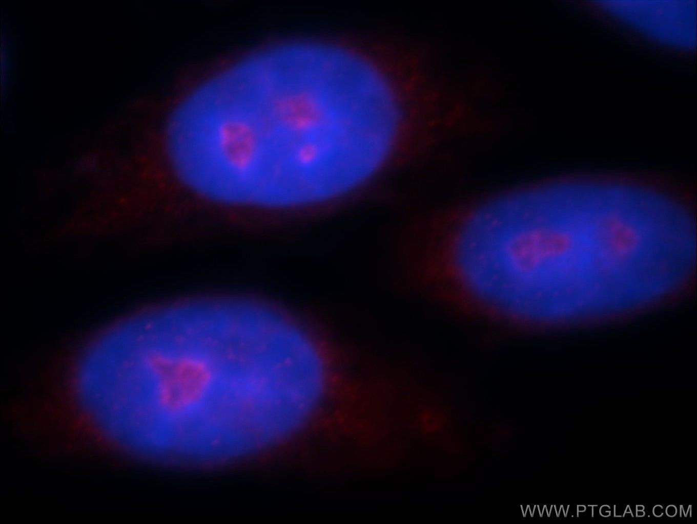 Immunofluorescence (IF) / fluorescent staining of HepG2 cells using ZNF74 Polyclonal antibody (21843-1-AP)