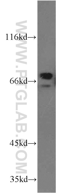 Western Blot (WB) analysis of Jurkat cells using ZNF74 Polyclonal antibody (21843-1-AP)